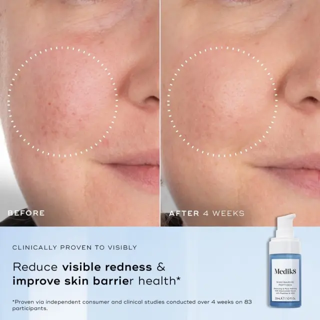 Medik8 Niacinamide Peptides Ορός Λείανσης/Λάμψης 30ml 3