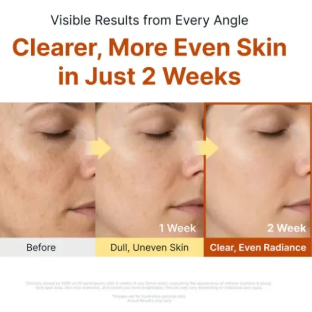 Sungboon Editor Kojic Acid Niacinamide Brightening Ampoule Ορός Προσώπου για Δυσχρωμίες και Λάμψη, 40ml 2