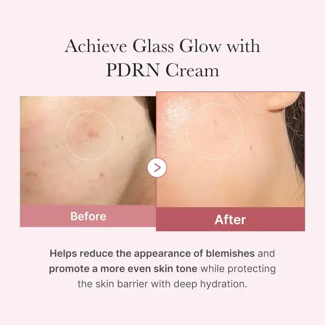 Medicube PDRN Pink Hyaluronic Κρέμα Προσώπου για Ενυδάτωση με Υαλουρονικό Οξύ & Νιασιναμίδη 50ml 3