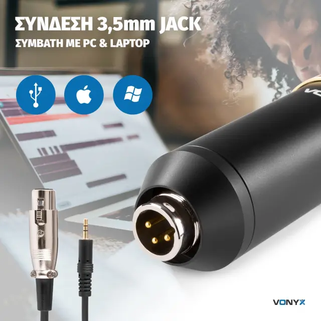 VONYX CM400B ΠΥΚΝΩΤΙΚΟ ΜΙΚΡΟΦΩΝΟ STUDIO ΜΑΥΡΟ /ΧΡΥΣΟ 2
