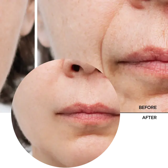 Revox B77 Just Peptides 10% Multi-Coctail Serum Αντιγηραντικός Ορός Προσώπου 30ml 3