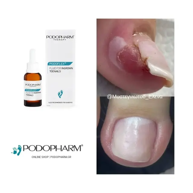 PODOFLEX® Fluid 3