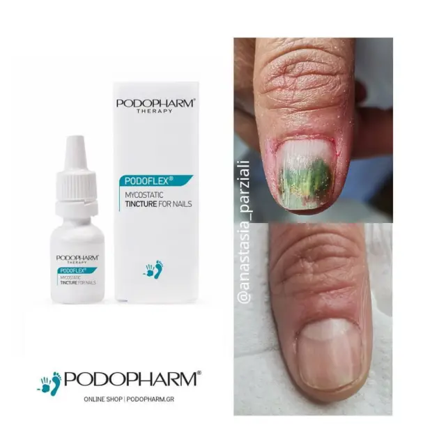 TINCTURE for nails mycosis 2