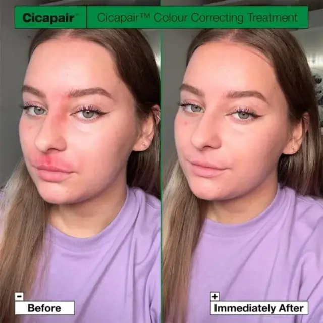 Dr. Jart+ Cicapair Tiger Grass Color Correcting Treatment Κρέμα Προσώπου που Προσαρμόζεται στο Χρώμα του Δέρματος, 50ml 2