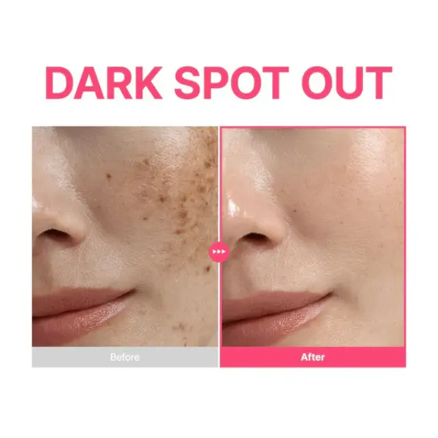 Purito Seoul Txa 6 Niacinamide 10 Retinal Serum – Ορός Κατά των Κηλίδων + της Υπερμελάγχρωσης 30ml 2