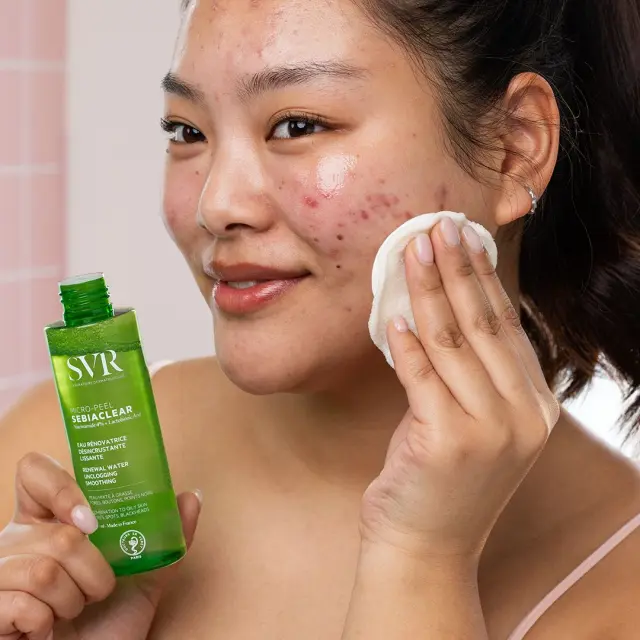 SVR Sebiaclear Micro-Peel Λοσιόν Απολέπισης και Λείανσης για Επιδερμίδα με Τάση Ακμής 150ml 2