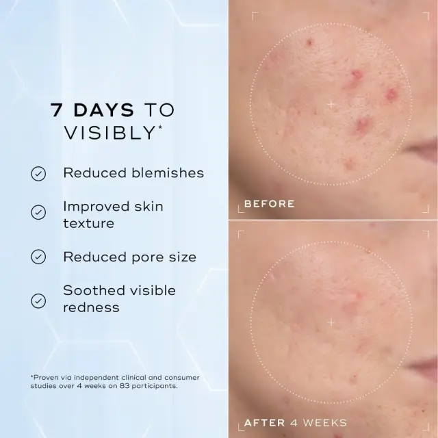 Medik8 Niacinamide Peptides Ορός Λείανσης/Λάμψης 30ml 2