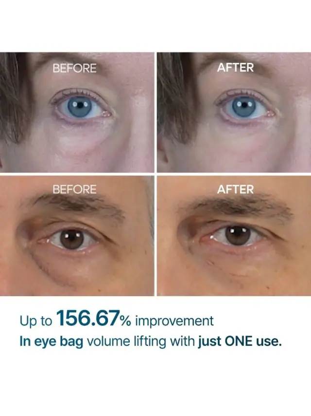 Dr.Melaxin Eyephalt Eyebag Cream Κρέμα ματιών με αποτέλεσμα lifting 10ml 3