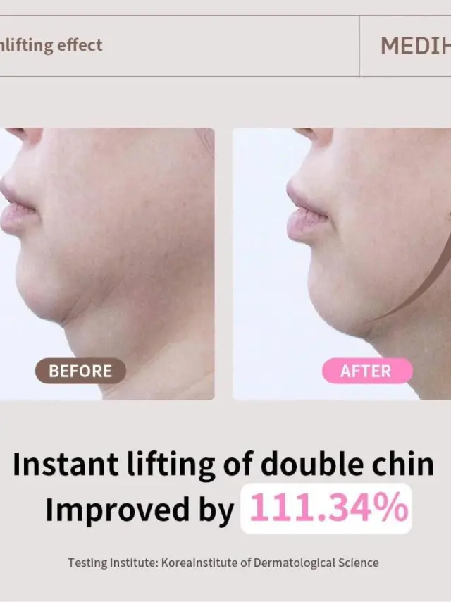 Mediheal Retinol Collagen Ampoule Lifting Mask -Μάσκα σύσφιξης και ανόρθωσης του οβαλ 2