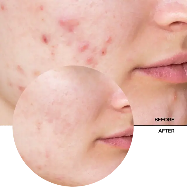 Revox B77 Just Niacinamide 10% Serum Ορός Προσώπου 30ml 3