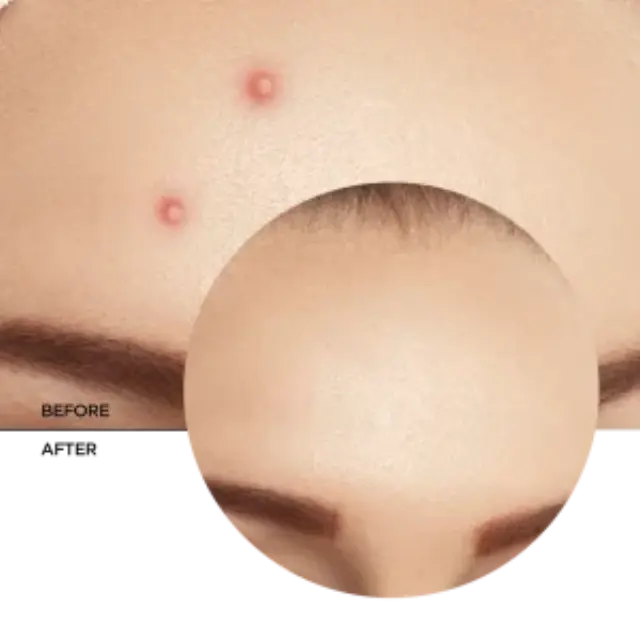 Revox B77 Zitcare AHA BHA PHA Spot Treatment Απολεπιστικό Προσώπου 25ml 3