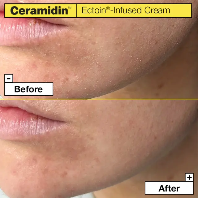 Dr. Jart+ Ceramidin Ectoin-Infused Rich Ενυδατική Κρέμα Προσώπου για Ξηρές Επιδερμίδες με Ceramides 50ml 2