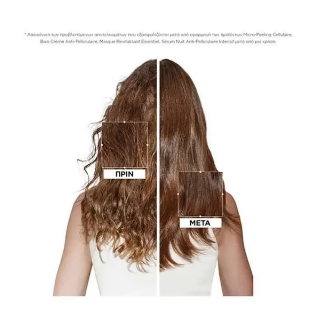 Kérastase Symbiose Micro-Peeling Cellulaire Αντιπιτυριδική Περιποίηση Μικροαπολέπισης 200ml 3