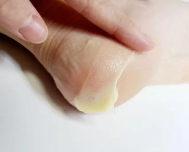 MEDI-PEEL EGF Scaling Moisture Foot Cream 2.0 Κρέμα ποδιών Medi-Peel EGF για ενυδάτωση και απολέπιση 130gr 3