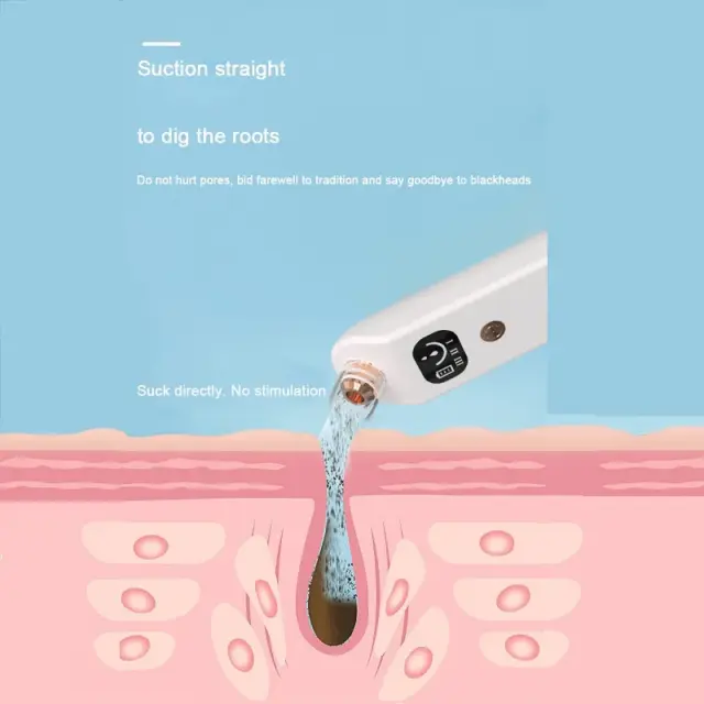 Συσκευή αναρρόφησης μαύρων στιγμάτων – Blackhead suction instrument – QA-T663 – QIAOYANG 2