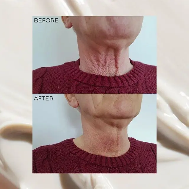 Nourish London T.S.L Tighten, Sculpt & Lift Neck Cream - Βιολογική Κρέμα Σύσφιξης & Ανόρθωσης Για τον Λαιμό 3