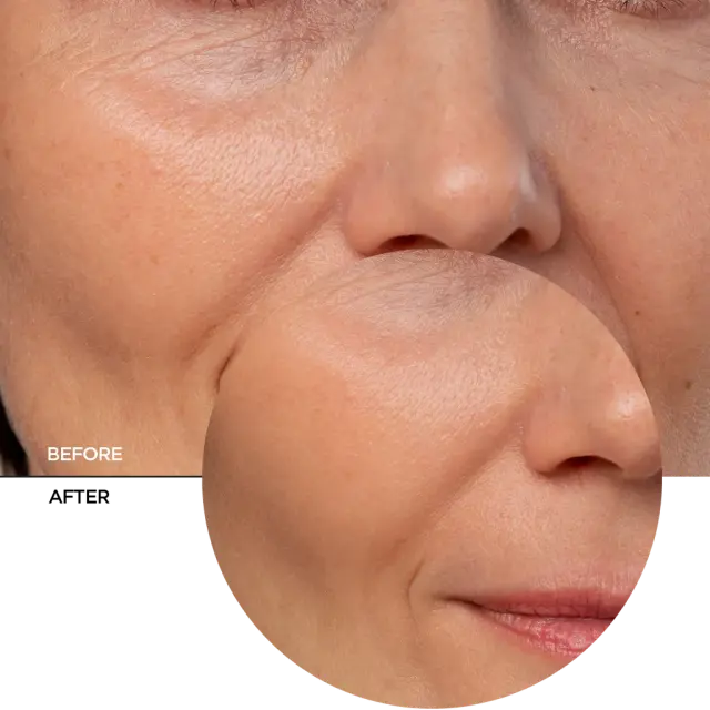 Revox B77 Just Coenzyme Q10 Serum Αντιγηραντικός Ορός 30ml 3