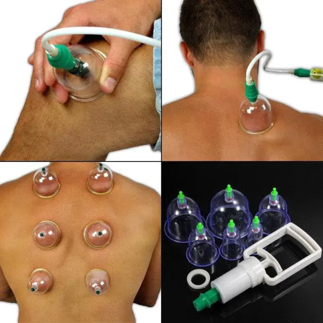 KL Θεραπευτική Συσκευή με Βεντούζες 24τμχ - Pull Out A Vacuum Apparatus 24pcs 002484 2