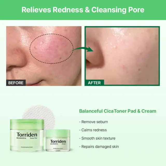 Torriden BALANCEFUL Cica Toner Pad 180ml- Απολεπιστικά καταπραϋντικά toner pads 2