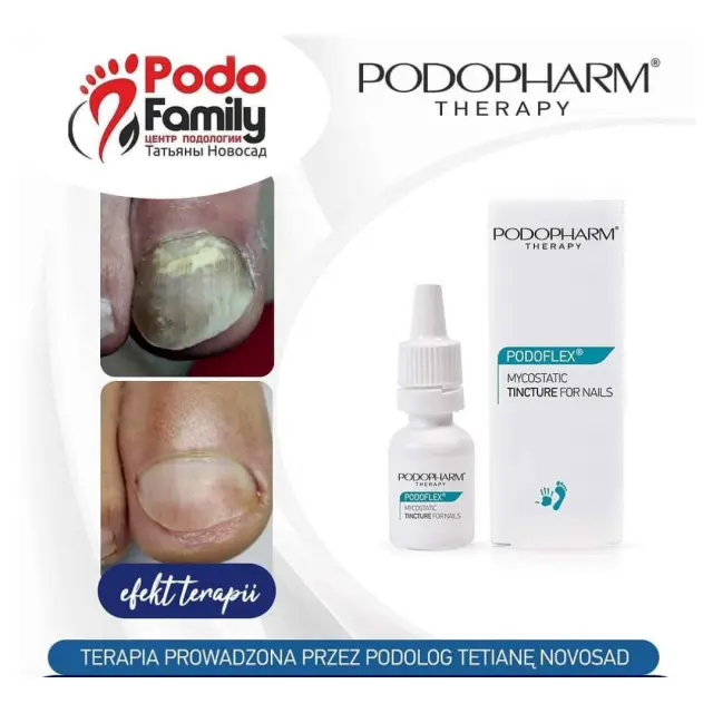 TINCTURE for nails mycosis 3