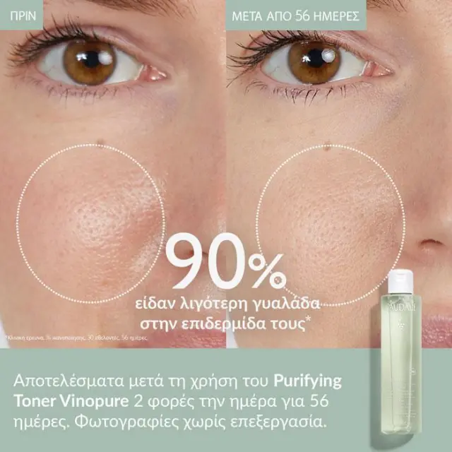 Caudalie Vinopure Clear Skin Purifying Toner Τονωτική Λοσιόν για Επιδερμίδα με Τάση Ακμής, 400ml 3