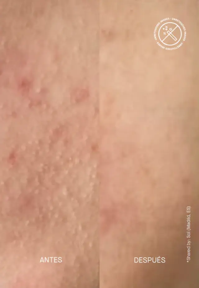 Niche Beauty Lab - Acnemy - Zitmask - Μάσκα θείου κατά των κηλίδων 100ml 2