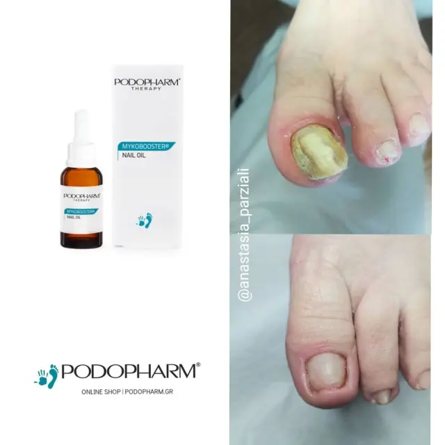 MYKOBOOSTER® nail oil 2