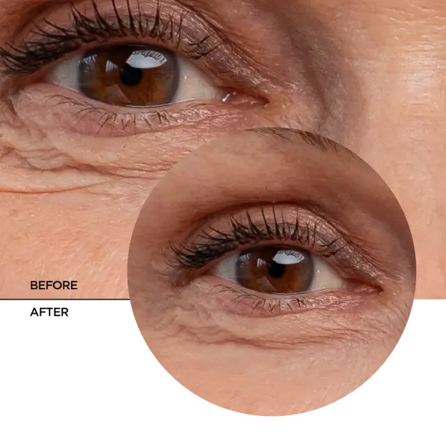 Revox B77 Retinol Eye Contour Gel Anti-Wrinkle Concentrate Serum Αντιρυτιδικό Τζελ Ματιών 30ml 3