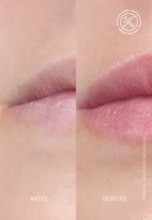 Niche Beauty Lab - Transparent Lab - Volume - Hydrating Lip-plumping Treatment 15ml 2