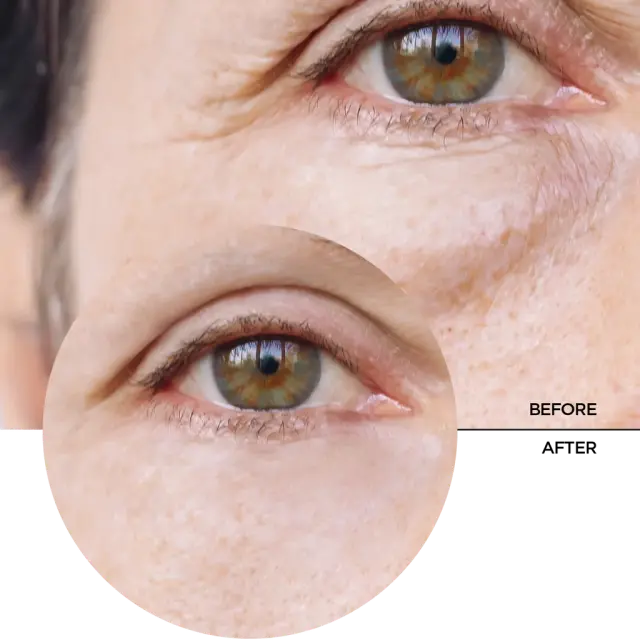 Revox B77 Just Caffeine 5% Serum Ορός Ματιών κατά των Μαύρων Κύκλων 30ml 3