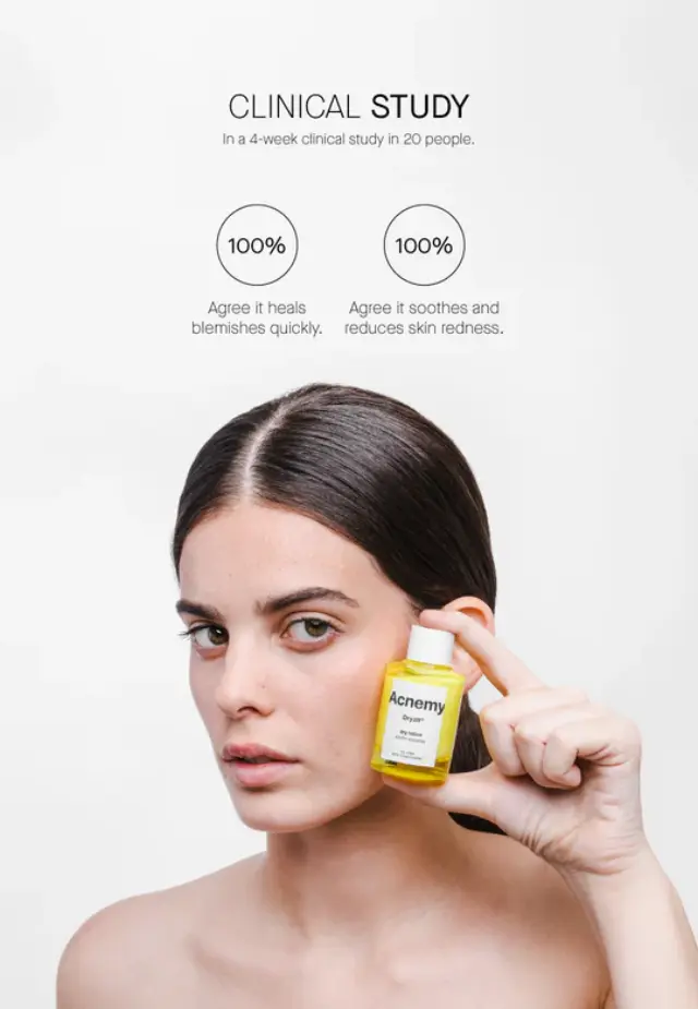 Niche Beauty Lab - Acnemy - Dryzit - Spot Drying Lotion 30ml 2