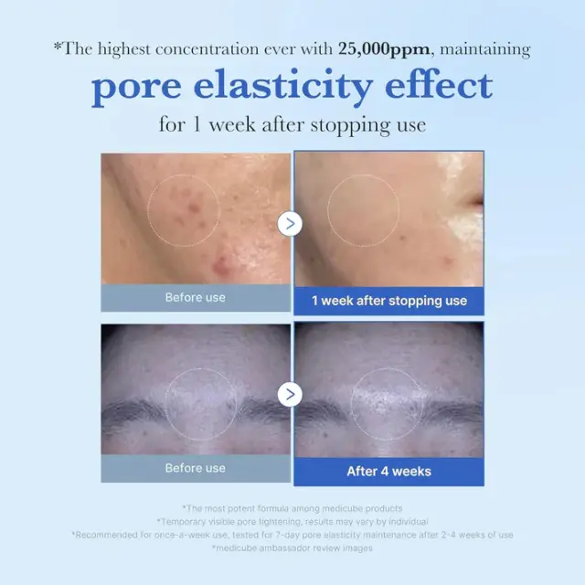 Medicube One Day Exosome Shot Pore Serum 25000 - Ορός Micro-needling για λεία υφή + φωτεινό δέρμα 13 ml 2