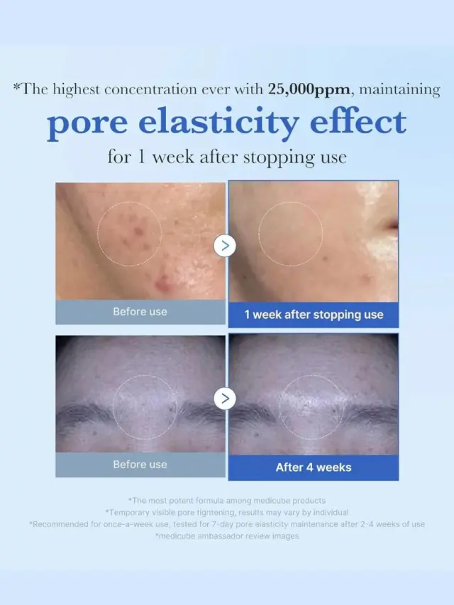Medicube One Day Exosome Shot Pore Serum 25000 - Ορός Προσώπου για Σύσφιξη Πόρων με τεχνολογία μικροβελόνων 3