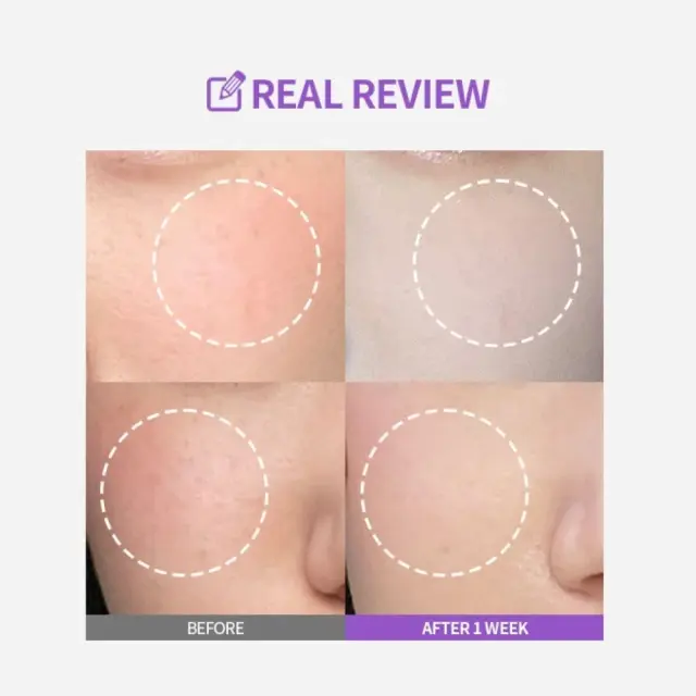 Sungboon Editor Meoru Podo Vita C Dark Spot Ampoule - Λευκαντική αμπούλα προσώπου 30ml 3