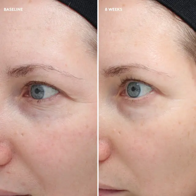 Colorescience Total Eye® Firm + Repair Cream 18ml 3