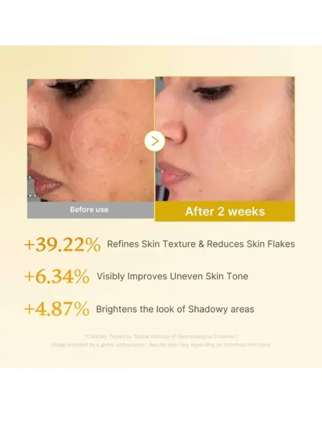 Medicube Kojic Acid Turmeric Resurfacing Toner 250ml - Τόνερ ήπιας απολέπισης και λάμψης με κοζικό οξύ και κουρκουμά 2