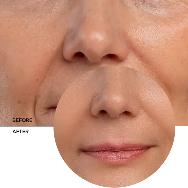 Revox B77 Just Retinal Serum Αντιγηραντικός ορός προσώπου με Ρετινόλη 30ml 3