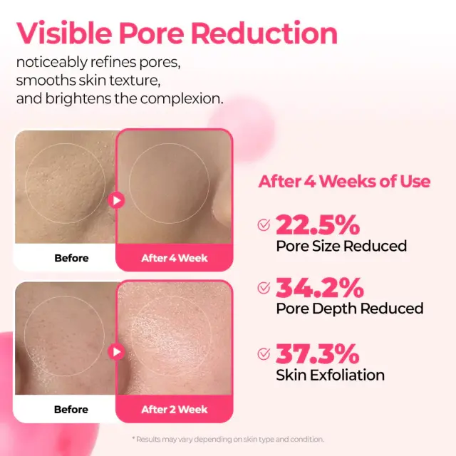Dr.Melaxin Cemenrete Cyano Pink Spicule Serum Ροζ Σερουμ Αναγέννησης με Βιταμίνη B12 30ml 3