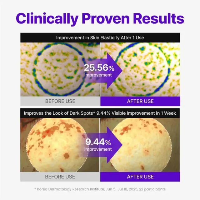 Centellian24 Expert Madeca Cream Active Renew Pdrn-kρέμα προσώπου με Pdrn για εντατική ανανέωση και επανόρθωση της επιδερμίδας 50ml 2