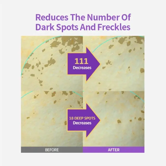 Sungboon Editor Meoru Podo Vita C Dark Spot Ampoule - Λευκαντική αμπούλα προσώπου 30ml 2