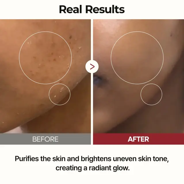 Dr.Melaxin Peel Shot Glow Rice Toner Τονωτική λοσιόν με εκχύλισμα ρυζιού 200ml 3