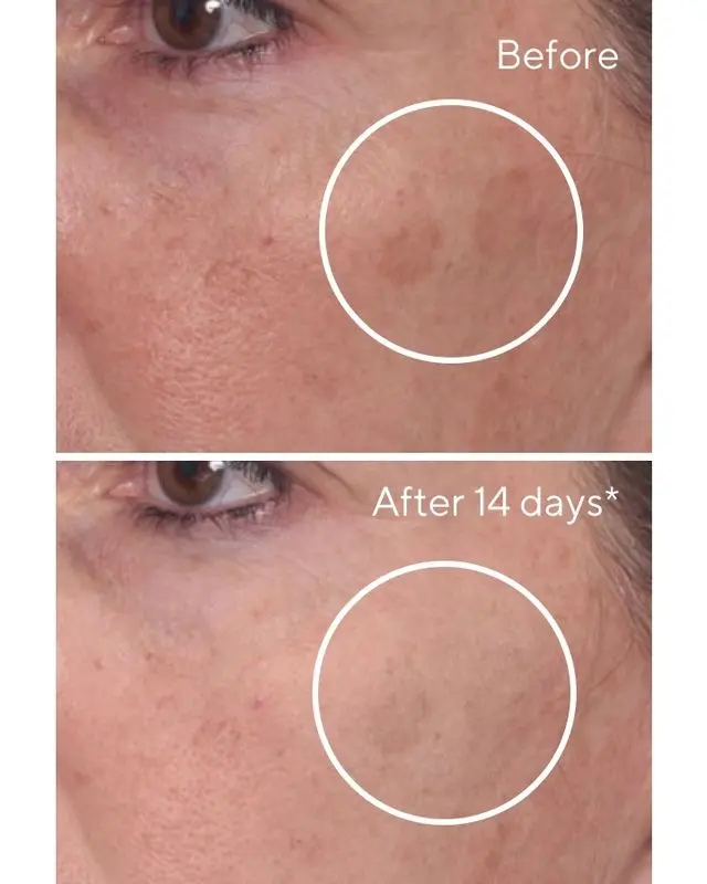 Murad Rapid Dark Spot Correcting Serum Ορός για Πανάδες 30ml 3