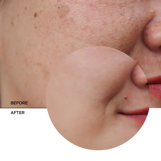 Revox B77 Skintreats Biotic Revitalising Radiance Cream Κρέμα προσώπου με υαλουρονικό οξύ και βιταμίνη C 50ml 3
