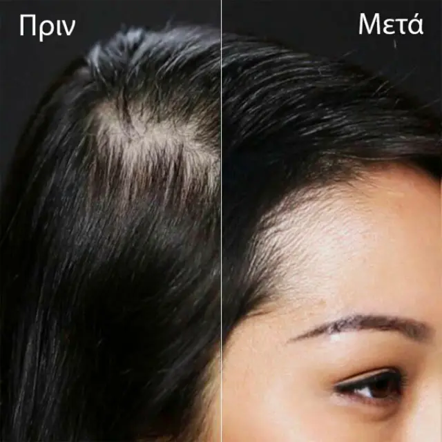 Toppik Hair Building Fibers Giant Size Medium Brown 55g 3