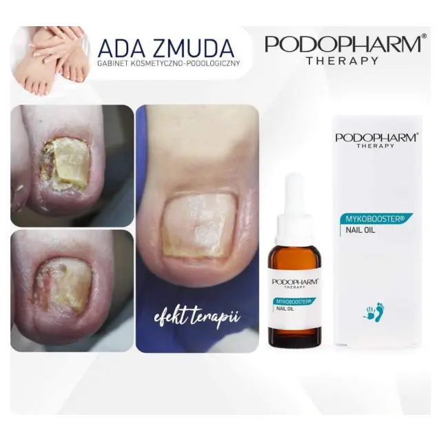 MYKOBOOSTER® nail oil 3