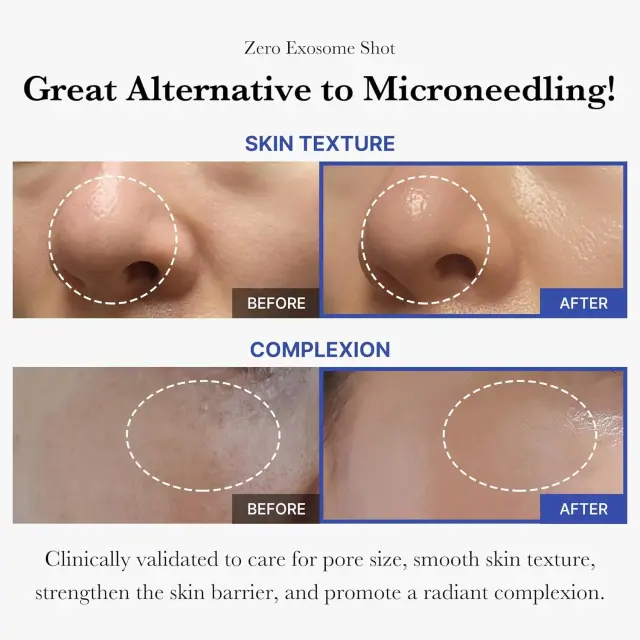 Medicube One Day Exosome Shot 2000 - Ορός με εξωσώματα και τεχνολογία microneedle 3