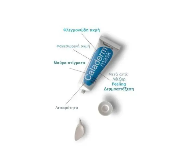 Evdermia Caladerm Mask Αποτελεσματική Μάσκα Προσώπου για Δέρματα με Πρόβλημα Ακμής , 30gr 2