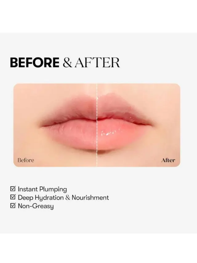 VT Reedle Shot Lip Plumper Beginner - Gloss με μικροβελόνες και εφέ όγκου 3
