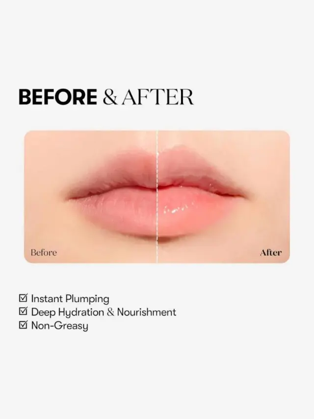 VT Reedle Shot Lip Plumper Expert - Gloss με μικροβελόνες και εφέ όγκου 3