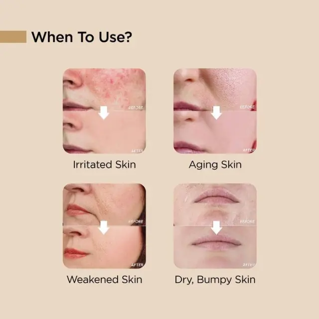 Bano:Bagi Milk Thistle Repair Serum 30ml 2